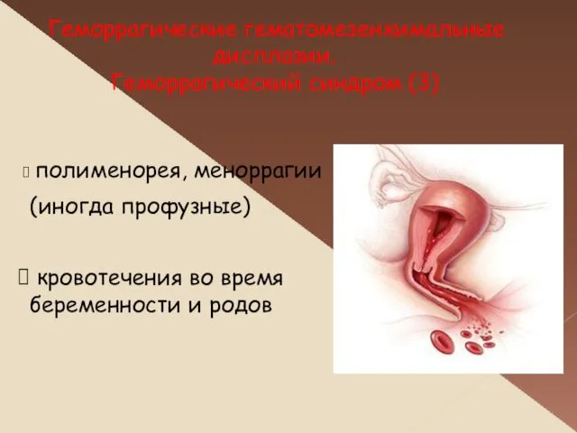 полименорея, меноррагии (иногда профузные) кровотечения во время беременности и родов Геморрагические гематомезенхимальные дисплазии. Геморрагический синдром (3)