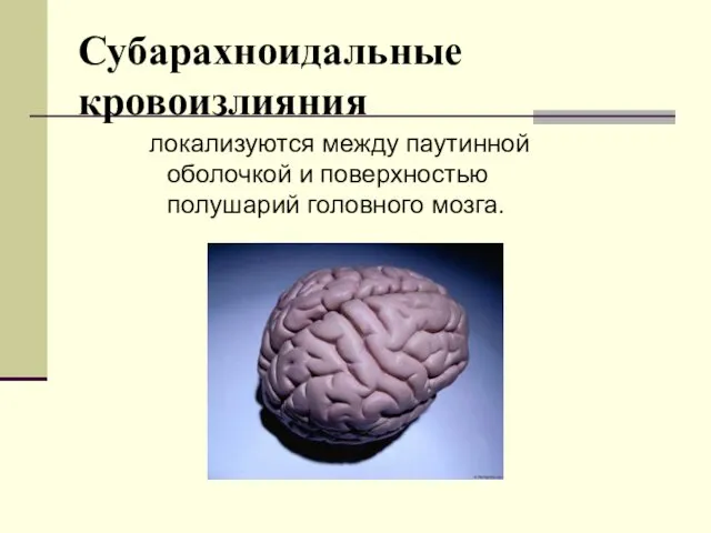 Субарахноидальные кровоизлияния локализуются между паутинной оболочкой и поверхностью полушарий головного мозга.