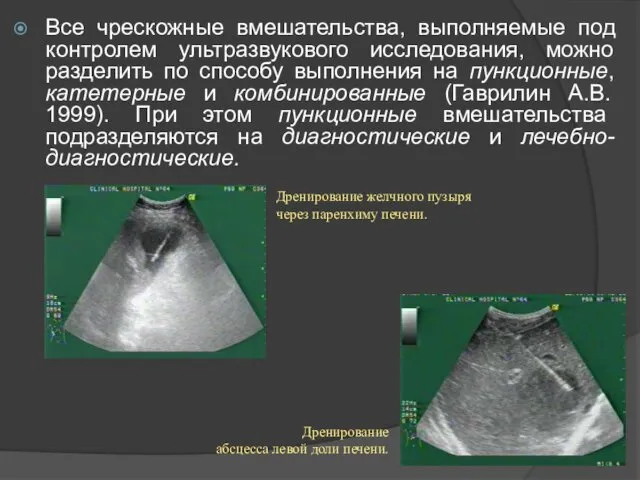 Все чрескожные вмешательства, выполняемые под контролем ультразвукового исследования, можно разделить по