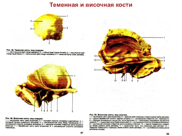 Теменная и височная кости