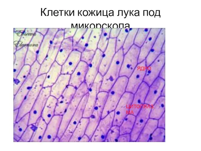 Клетки кожица лука под микорскопа ЯДРО ЦИТОПЛАЗМА