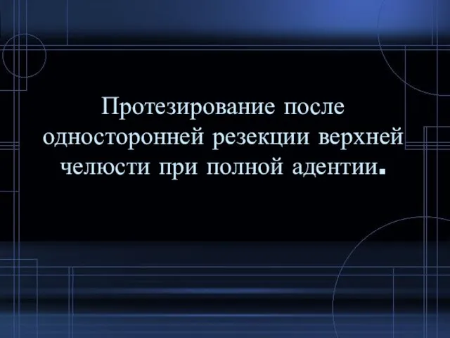 Протезирование после односторонней резекции верхней челюсти при полной адентии.