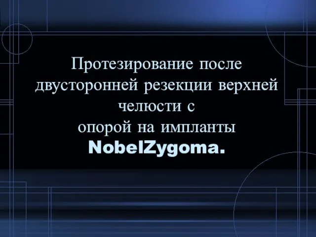 Протезирование после двусторонней резекции верхней челюсти с опорой на импланты NobelZygoma.