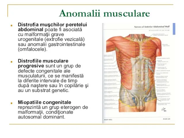 Anomalii musculare Distrofia muşchilor peretelui abdominal poate fi asociată cu malformaţii