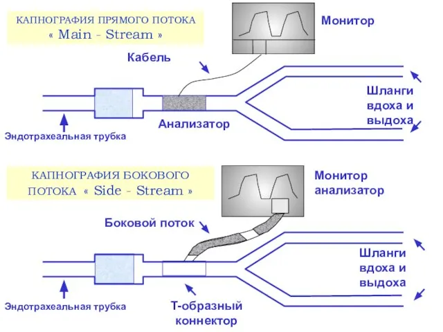 КАПНОГРАФИЯ ПРЯМОГО ПОТОКА « Main - Stream » КАПНОГРАФИЯ БОКОВОГО ПОТОКА