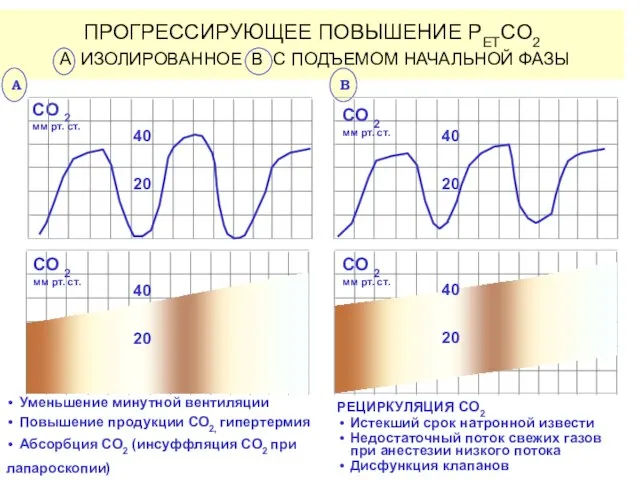 ПРОГРЕССИРУЮЩЕЕ ПОВЫШЕНИЕ PETCO2 A ИЗОЛИРОВАННОЕ B С ПОДЪЕМОМ НАЧАЛЬНОЙ ФАЗЫ B