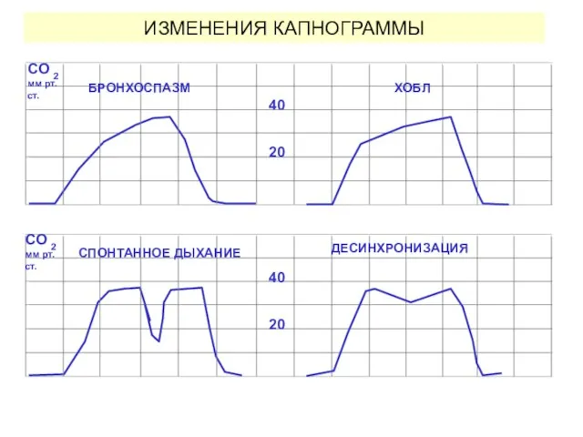 ИЗМЕНЕНИЯ КАПНОГРАММЫ 20 40 CO 2 мм рт. ст. 20 40