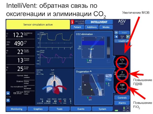 IntelliVent: обратная связь по оксигенации и элиминации CO2 Увеличение МОВ Повышение ПДКВ Повышение FiO2