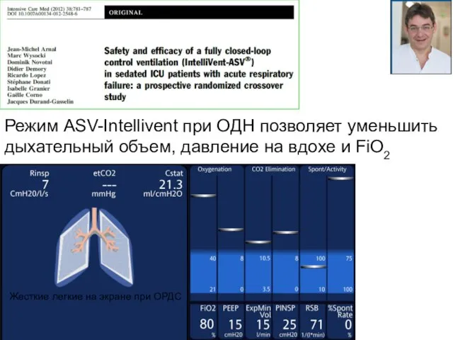 Жесткие легкие на экране при ОРДС Режим ASV-Intellivent при ОДН позволяет