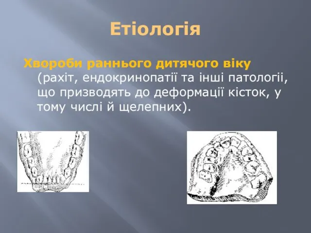 Етіологія Хвороби paнньoгo дитячого віку (рахіт, eндокринопатії та інші патологіі, що