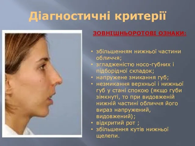 Діагностичні критерії , ЗОВНІШНЬОРОТОВІ ОЗНАКИ: збільшенням нижньої частини обличчя; згладженістю носо-гyбних