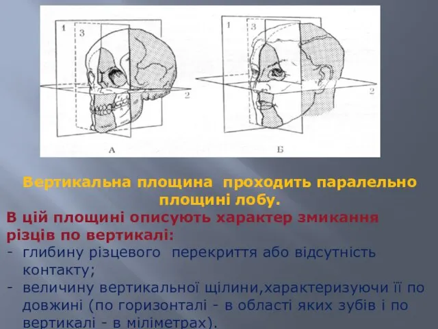 Вертикальна площина проходить паралельно площині лобу. В цій площині описують характер