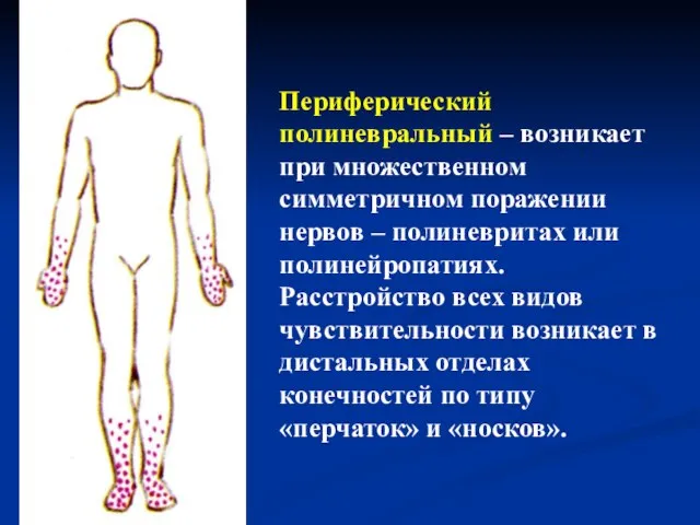 Периферический полиневральный – возникает при множественном симметричном поражении нервов – полиневритах