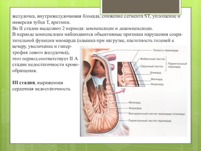 желудочка, внутрижелудочковая блокада, снижение сегмента ST, уплощение и инверсия зубца Т,