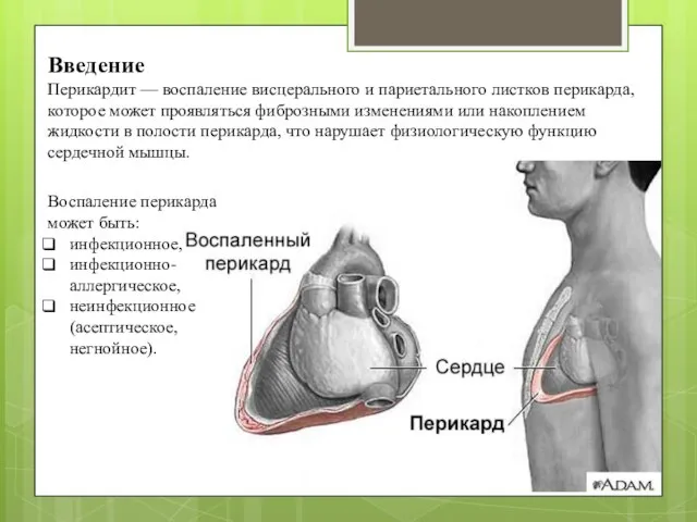 Введение Перикардит — воспаление висцерального и париетального листков перикарда, которое может