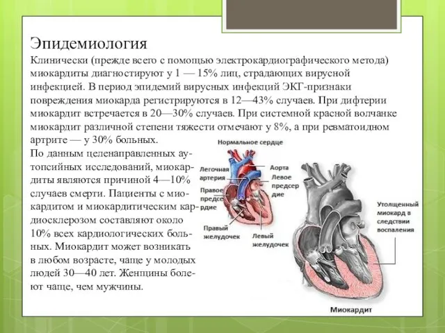 Эпидемиология Клинически (прежде всего с помощью электрокардиографического метода) миокардиты диагностируют у