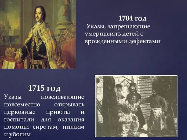 1704 год Указы, запрещающие умерщвлять детей с врожденными дефектами 1715 год