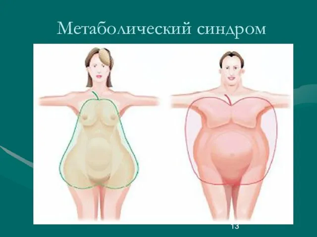 Метаболический синдром