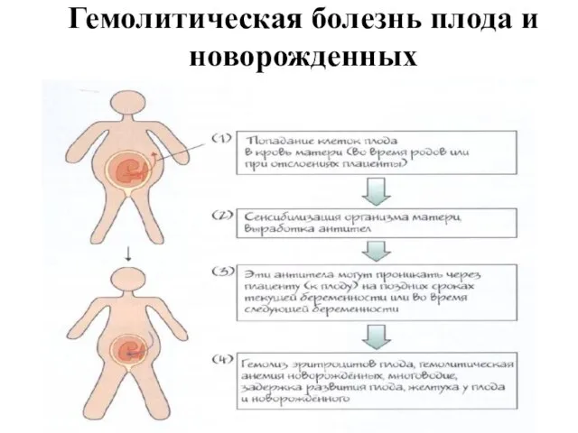 Гемолитическая болезнь плода и новорожденных