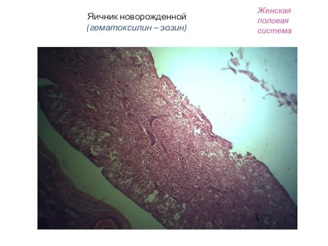 Яичник новорожденной (гематоксилин – эозин) Женская половая система