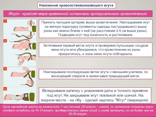 Наложение кровоостанавливающего жгута Жгут - крайняя мера временной остановки артериального кровотечения.