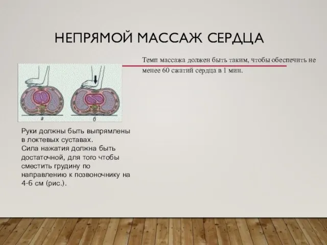 НЕПРЯМОЙ МАССАЖ СЕРДЦА Темп массажа должен быть таким, чтобы обеспечить не