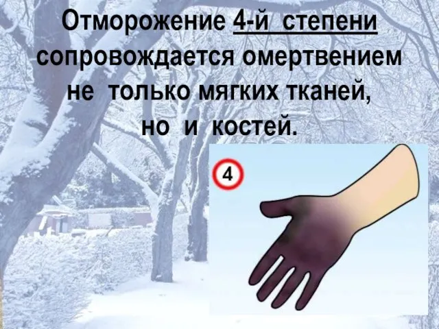 Отморожение 4-й степени сопровождается омертвением не только мягких тканей, но и костей.