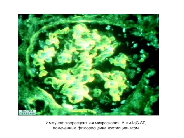 Иммунофлюоресцентная микроскопия. Анти-IgG-АТ, помеченные флюоресцеина изотиоцианатом