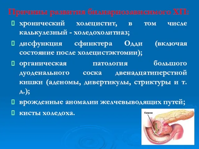 Причины развития билиарнозависимого ХП: хронический холецистит, в том числе калькулезный -