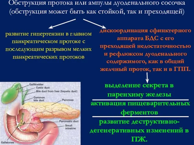 Обструкция протока или ампулы дуоденального сосочка (обструкция может быть как стойкой,