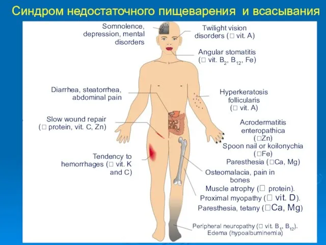 Синдром недостаточного пищеварения и всасывания Somnolence, depression, mental disorders Diarrhea, steatorrhea,