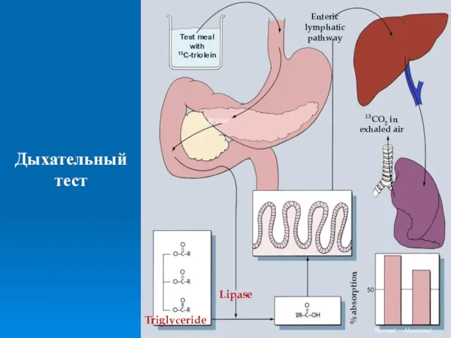 Дыхательный тест Test meal with 13C-triolein Lipase Lipase Triglyceride Enterocyte Enteric