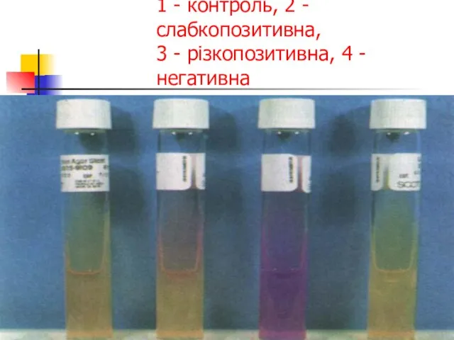 Продукція уреази на середовищі Крістенсена (гідроліз сечовини до амонію): 1 -