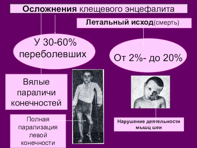 Осложнения клещевого энцефалита У 30-60% переболевших От 2%- до 20% Летальный