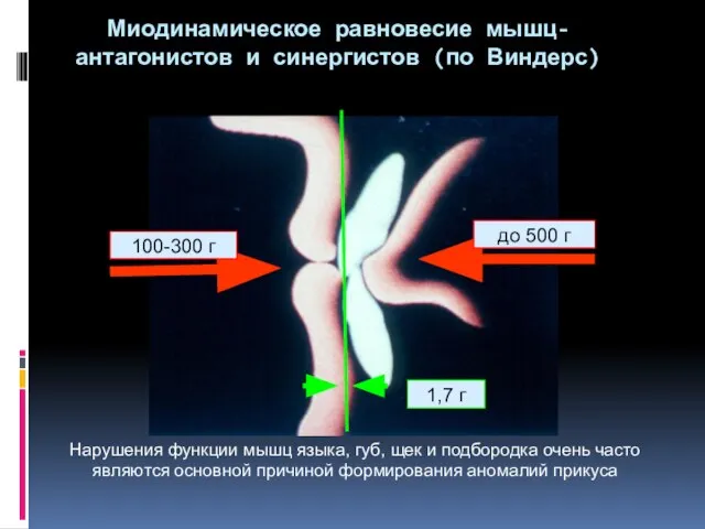 Миодинамическое равновесие мышц-антагонистов и синергистов (по Виндерс) 1,7 г до 500