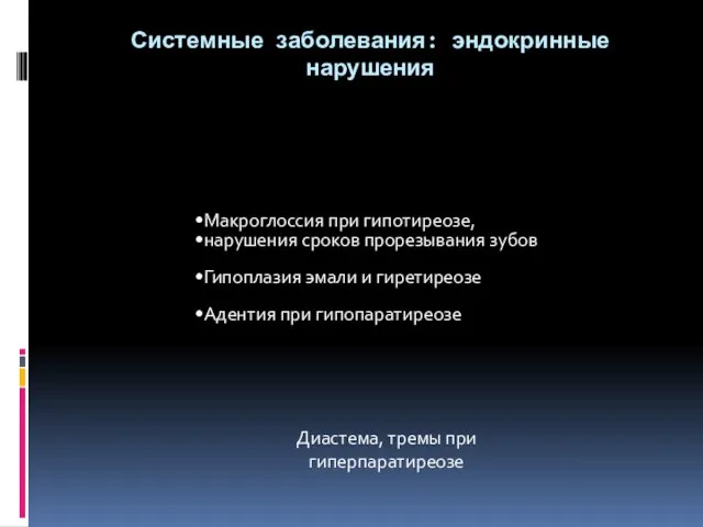 Системные заболевания: эндокринные нарушения Макроглоссия при гипотиреозе, нарушения сроков прорезывания зубов