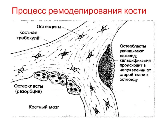 Процесс ремоделирования кости