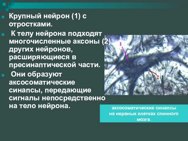 Крупный нейрон (1) с отростками. К телу нейрона подходят многочисленные аксоны