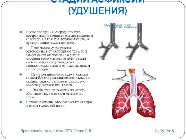 СТАДИИ АСФИКСИИ (УДУШЕНИЯ) 24.02.2012 Преподаватель-организатор ОБЖ Котлов В.В. После попадания инородного