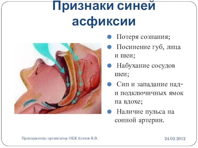 Признаки синей асфиксии 24.02.2012 Преподаватель-организатор ОБЖ Котлов В.В. Потеря сознания; Посинение