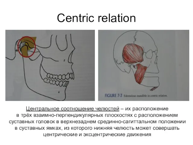Centric relation Центральное соотношение челюстей – их расположение в трёх взаимно-перпендикулярных