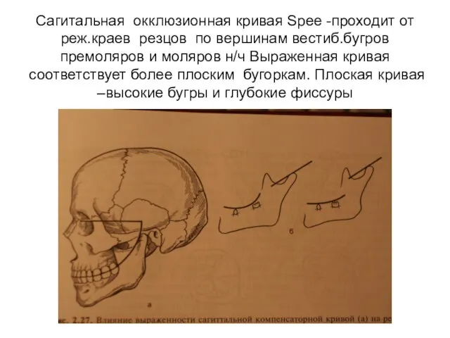 Сагитальная окклюзионная кривая Spee -проходит от реж.краев резцов по вершинам вестиб.бугров