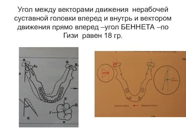 Угол между векторами движения нерабочей суставной головки вперед и внутрь и