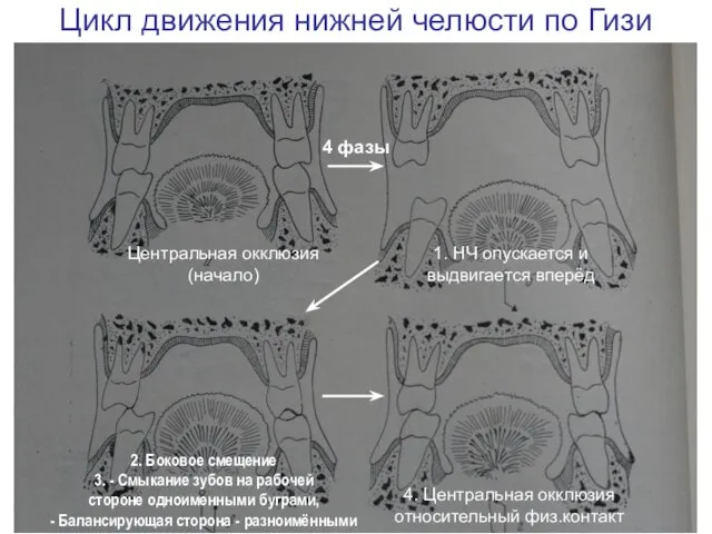 Цикл движения нижней челюсти по Гизи Центральная окклюзия (начало) 4 фазы