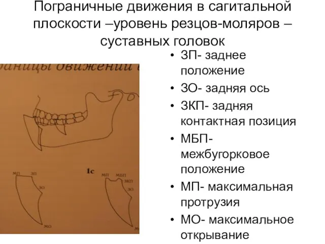 Пограничные движения в сагитальной плоскости –уровень резцов-моляров –суставных головок ЗП- заднее