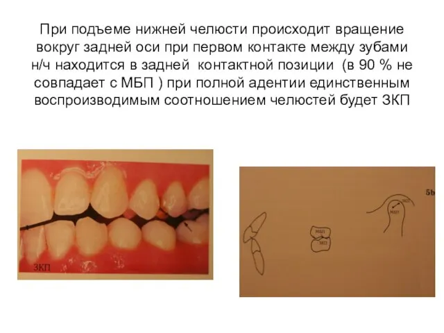 При подъеме нижней челюсти происходит вращение вокруг задней оси при первом