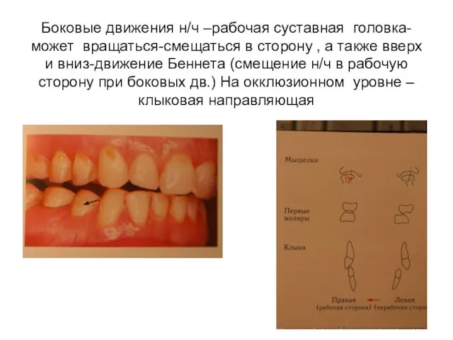 Боковые движения н/ч –рабочая суставная головка-может вращаться-смещаться в сторону , а