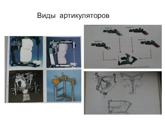 Виды артикуляторов