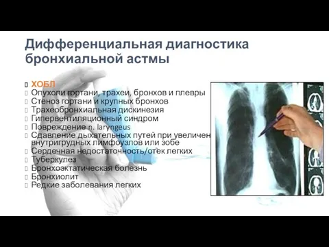 Дифференциальная диагностика бронхиальной астмы ХОБЛ Опухоли гортани, трахеи, бронхов и плевры