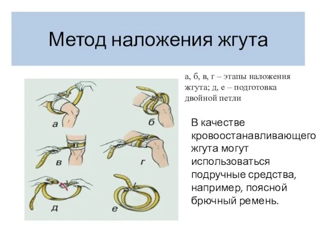 Метод наложения жгута а, б, в, г – этапы наложения жгута;